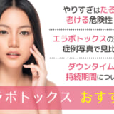 品川美容外科のエラボトックスは効果ないって本当 口コミや症例と合わせて解説 Wellbeauty